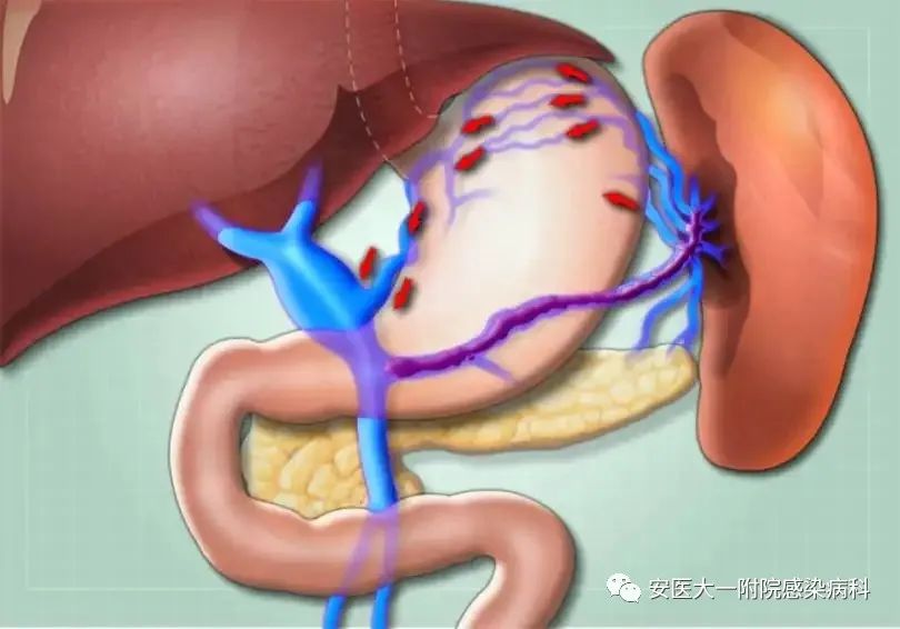 食管胃底静脉曲张的饮食指导_食管胃底静脉曲张吃什么药治疗_食管胃底静脉曲张饮食