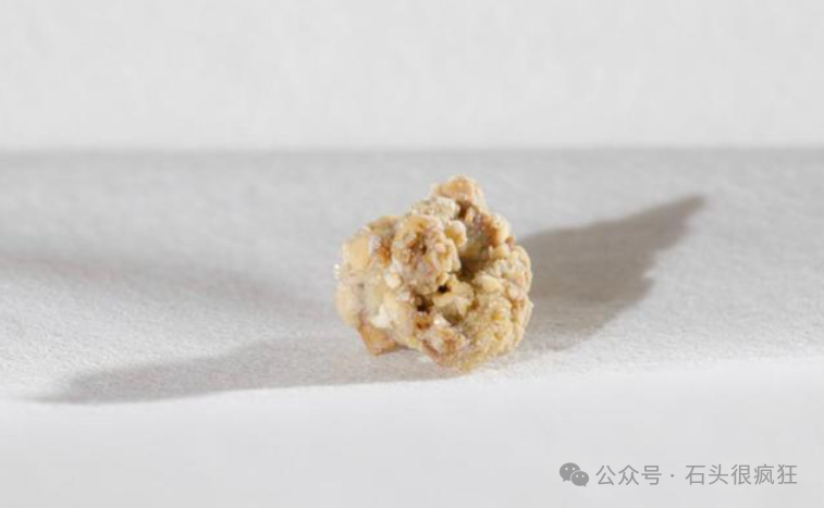 肾结石饮食要注意哪些_肾饮食结石注意要注意什么_肾结石饮食注意哪些事项