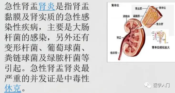 肾盂肾炎饮食-肾盂肾炎在饮食上注意什么