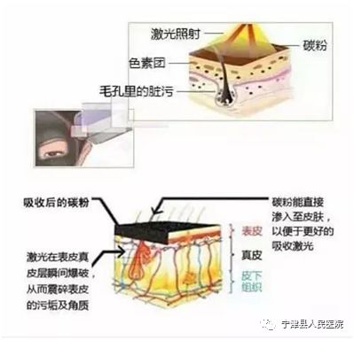 做黑脸娃娃后能化妆吗_做黑脸娃娃后可以化妆_做完黑脸娃娃不能化妆了