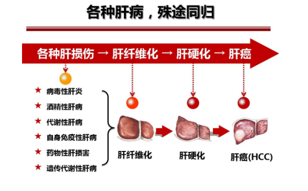 轻度脂肪肝的饮食菜单_轻度脂肪肝食物_轻度脂肪肝的健康营养餐